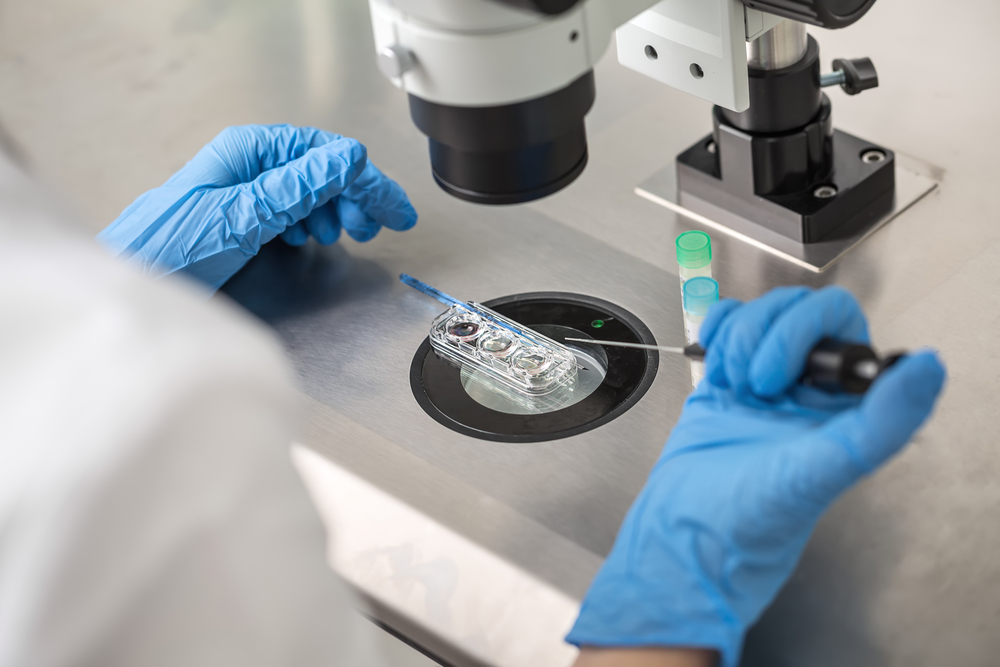 Commonly Asked IVF Questions