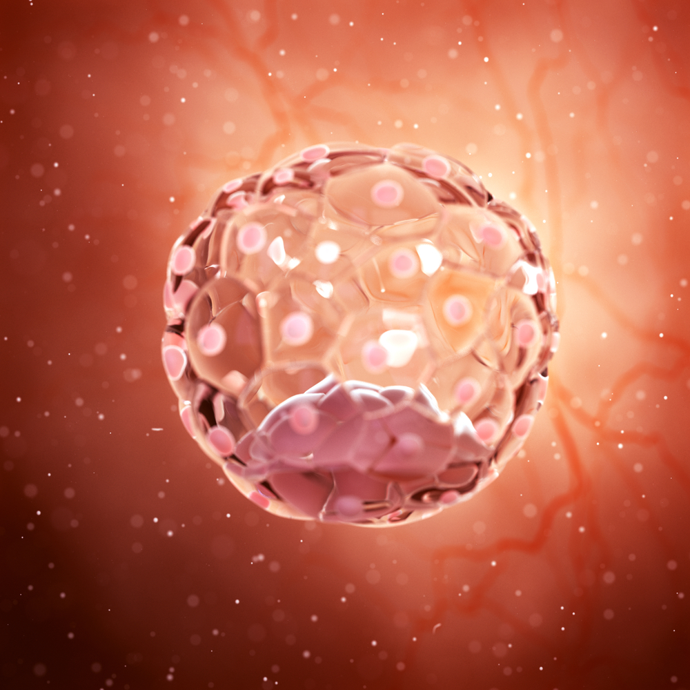 Understanding Recurrent Implantation Failure